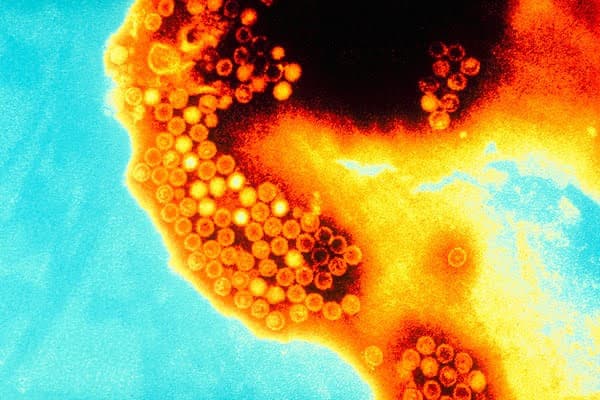 Estado de São Paulo registra alta de 144% no número de casos de hepatite A em 2023